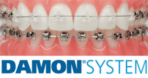 Damon system
