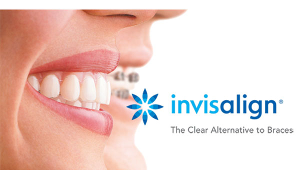 Invisalign